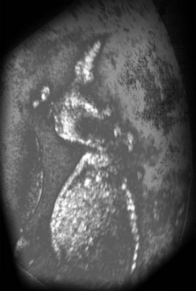 baby in  the fifth month
